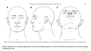 Sublabial Excision SEMINAR-11.pptx parotidectomy and submandibular salivary gland excision ...