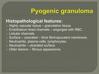 Histopathological features: 
 Highly vascular tissue – granulation tissue. 
 Endothelium lined channels – engorged with RBC. 
 Lobular channels. 
 Surface – ulcerated – thick fibrinopurulent membrane. 
 Neutrophils, plasma cells, lymphocytes. 
 Neutrophils – ulcerated surface. 
 Older lesions – fibrous appearance. 
 