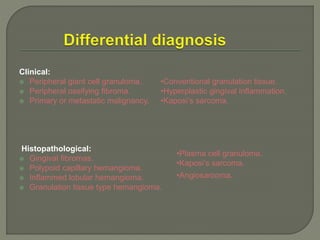Clinical: 
 Peripheral giant cell granuloma. 
 Peripheral ossifying fibroma. 
 Primary or metastatic malignancy. 
Histopathological: 
 Gingival fibromas. 
 Polypoid capillary hemangioma. 
 Inflammed lobular hemangioma. 
•Conventional granulation tissue. 
•Hyperplastic gingival inflammation. 
•Kaposi’s sarcoma. 
 Granulation tissue type hemangioma. 
•Plasma cell granuloma. 
•Kaposi’s sarcoma. 
•Angiosarcoma. 
 