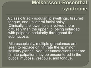 A classic triad - nodular lip swellings, fissured 
tongue, and unilateral facial palsy 
Clinically, the lower lip is involved more 
diffusely than the upper lip, being enlarged 
with palpable nodularity throughout the 
submucosa. 
Microscopically, multiple granulomas are 
seen to replace or infiltrate the lip minor 
salivary glands. Nodular tumefactions that are 
firm to palpation may be encountered in the 
buccal mucosa, vestibule, and tongue. 
 