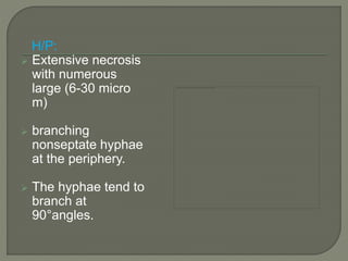 H/P: 
 Extensive necrosis 
with numerous 
large (6-30 micro 
m) 
 branching 
nonseptate hyphae 
at the periphery. 
 The hyphae tend to 
branch at 
90°angles. 
 
