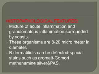 HISTOPATHOLOGICAL FEATURES: 
 Mixture of acute inflammation and 
granulomatous inflammation surrounded 
by yeasts. 
 These organisms are 8-20 micro meter in 
diameter. 
 B.dermatitidis can be detected-special 
stains such as gromatt-Gomori 
methenamine silver&PAS. 
 
