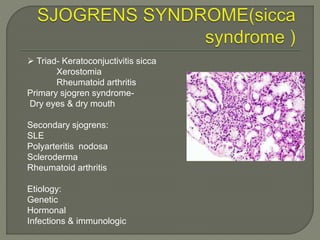  Triad- Keratoconjuctivitis sicca 
Xerostomia 
Rheumatoid arthritis 
Primary sjogren syndrome- 
Dry eyes & dry mouth 
Secondary sjogrens: 
SLE 
Polyarteritis nodosa 
Scleroderma 
Rheumatoid arthritis 
Etiology: 
Genetic 
Hormonal 
Infections & immunologic 
 