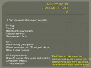 The lobular architecture of the 
seromucinous glands is preserved. The 
seromucinous acini show squamous 
metaplasia with slight reactive atypia. 
 Non neoplastic inflammatory condition 
Etiology: 
Trauma 
Radiation therapy/ surgery 
Vascular ischemia 
Tobacco – risk factor 
C/F: 
Minor salivary gland-palate 
Others retromolar pad, BM,tongue,incisive 
Canal & labial mucosa 
Clinical presentation: 
Crateriform ulcer of the palate that similates 
A malignant process. 
1-3cm & unilateral 
 