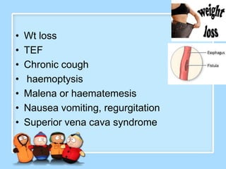 •   Wt loss
•   TEF
•   Chronic cough
•   haemoptysis
•   Malena or haematemesis
•   Nausea vomiting, regurgitation
•   Superior vena cava syndrome
 