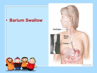 • Barium Swallow
 