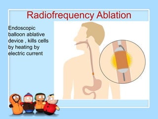 Radiofrequency Ablation
Endoscopic
balloon ablative
device , kills cells
by heating by
electric current
 