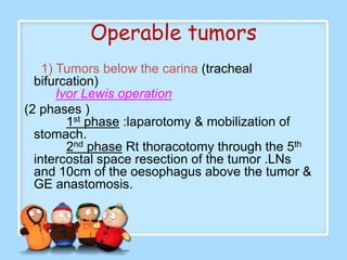 Operable tumors
    1) Tumors below the carina (tracheal
  bifurcation)
       Ivor Lewis operation
(2 phases )
         1st phase :laparotomy & mobilization of
  stomach.
         2nd phase Rt thoracotomy through the 5th
  intercostal space resection of the tumor .LNs
  and 10cm of the oesophagus above the tumor &
  GE anastomosis.
 
