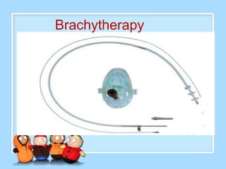 Brachytherapy
 