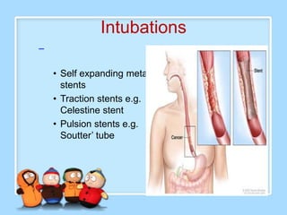 Intubations
–

    • Self expanding metal
      stents
    • Traction stents e.g.
      Celestine stent
    • Pulsion stents e.g.
      Soutter’ tube
 