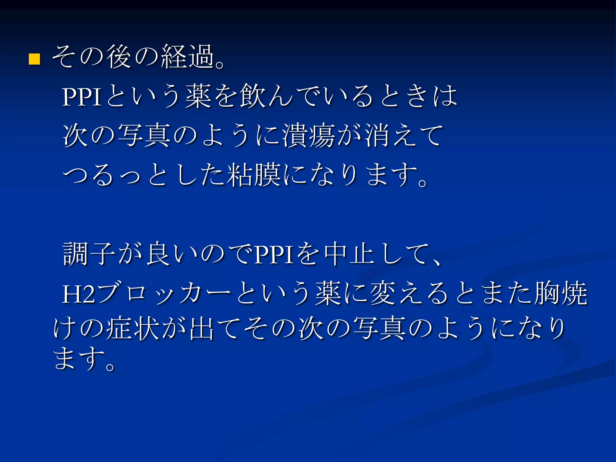    その後の経過。
    PPIという薬を飲んでいるときは
    次の写真のように潰瘍が消えて
    つるっとした粘膜になります。

    調子が良いのでPPIを中止して、
    H2ブロッカーという薬に変えるとまた胸焼
    けの症状が出てその次の写真のようになり
    ます。
 