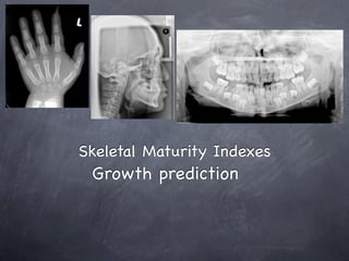 Skeletal Maturity Indexes
 Growth prediction
 
