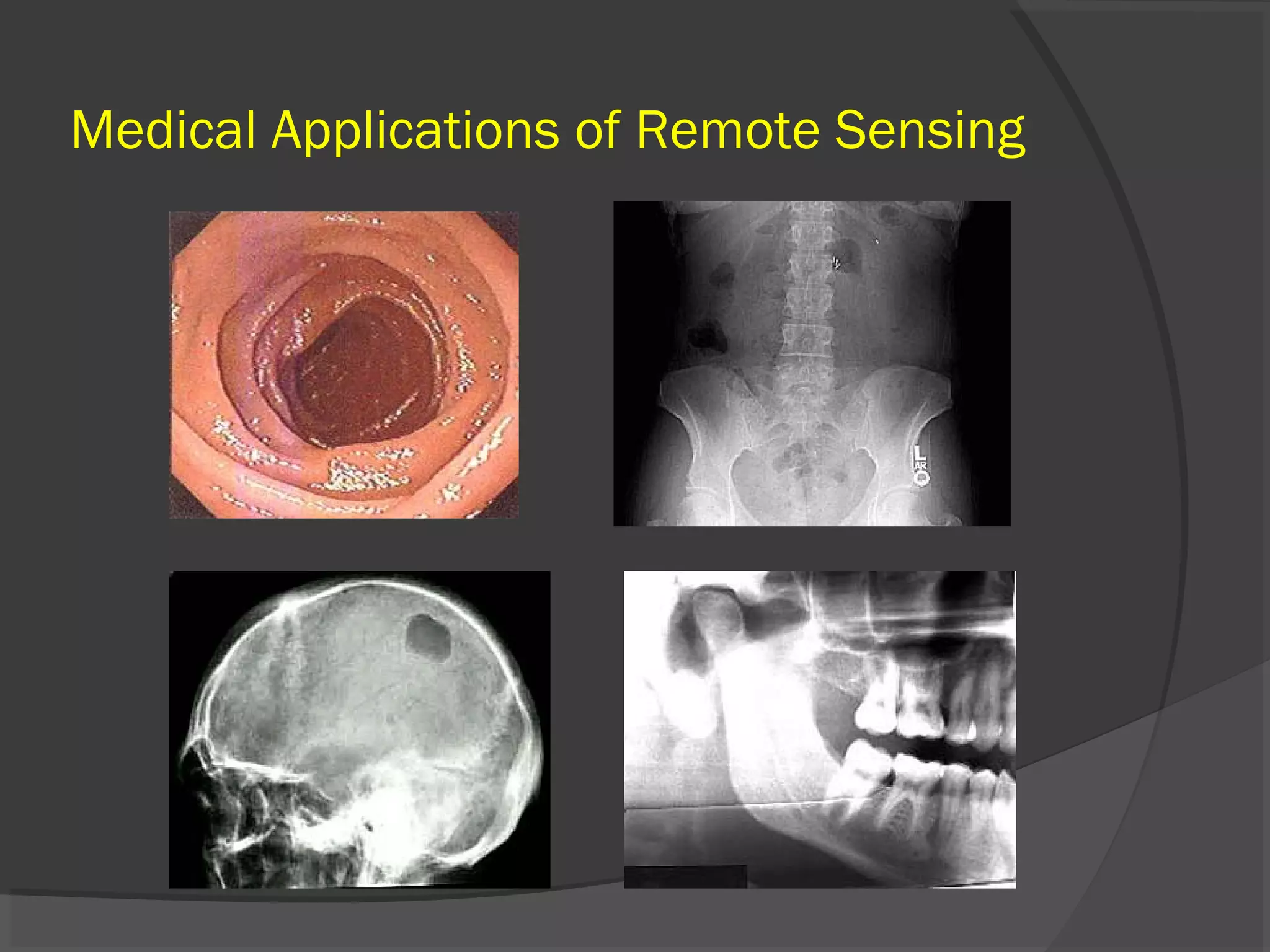 Medical Applications of Remote Sensing

 