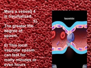 More a vessel( 4
is traumatized.
5(
The greater the
degree of
spasm.
6( This local
vascular spasm
can last for
many minutes or
even hours

 