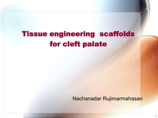 Tissue engineering scaffolds
for cleft palate

Nachanadar Rujimarmahasan

1

 