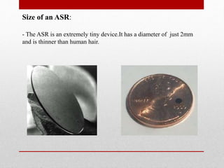 ARTIFICIAL RETINA/EYE (ASR,BIONIC EYE) | PPTX