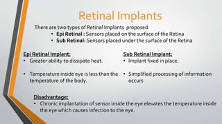 Retinal Implants
There are two types of Retinal Implants proposed
• Epi Retinal : Sensors placed on the surface of the Retina
• Sub Retinal: Sensors placed under the surface of the Retina
Sub Retinal Implant:
• Implant fixed in place.
• Simplified processing of information
occurs
Epi Retinal Implant:
• Greater ability to dissipate heat.
• Temperature inside eye is less than the
temperature of the body.
Disadvantage:
• Chronic implantation of sensor inside the eye elevates the temperature inside
the eye which causes infection to the eye.
 