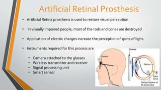 Artificial Retinal Prosthesis
• Artificial Retina prosthesis is used to restore visual perception
• In visually impaired people, most of the rods and cones are destroyed
• Application of electric charges increase the perception of spots of light.
• Instruments required for this process are
• Camera attached to the glasses
• Wireless transmitter and receiver
• Signal processing unit
• Smart sensor
 