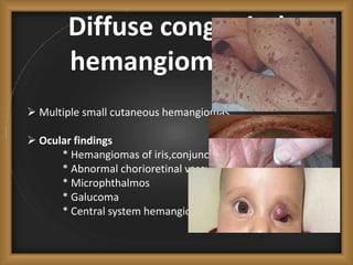 Diffuse congenital
hemangiomatosis
 Multiple small cutaneous hemangiomas.
 Ocular findings
* Hemangiomas of iris,conjunctiva & lid.
* Abnormal chorioretinal vasculature
* Microphthalmos
* Galucoma
* Central system hemangiomas - cortical blindness.
 