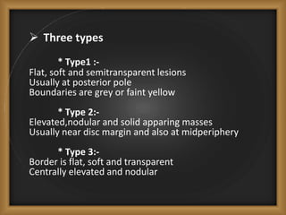  Three types
* Type1 :-
Flat, soft and semitransparent lesions
Usually at posterior pole
Boundaries are grey or faint yel...