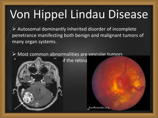 Von Hippel Lindau Disease
 Autosomal dominantly inherited disorder of incomplete
penetrance manifesting both benign and m...
