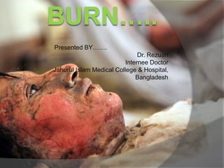 Presented BY…….
Dr. Rezuan
Internee Doctor
Jahurul Islam Medical College & Hospital,
Bangladesh
 