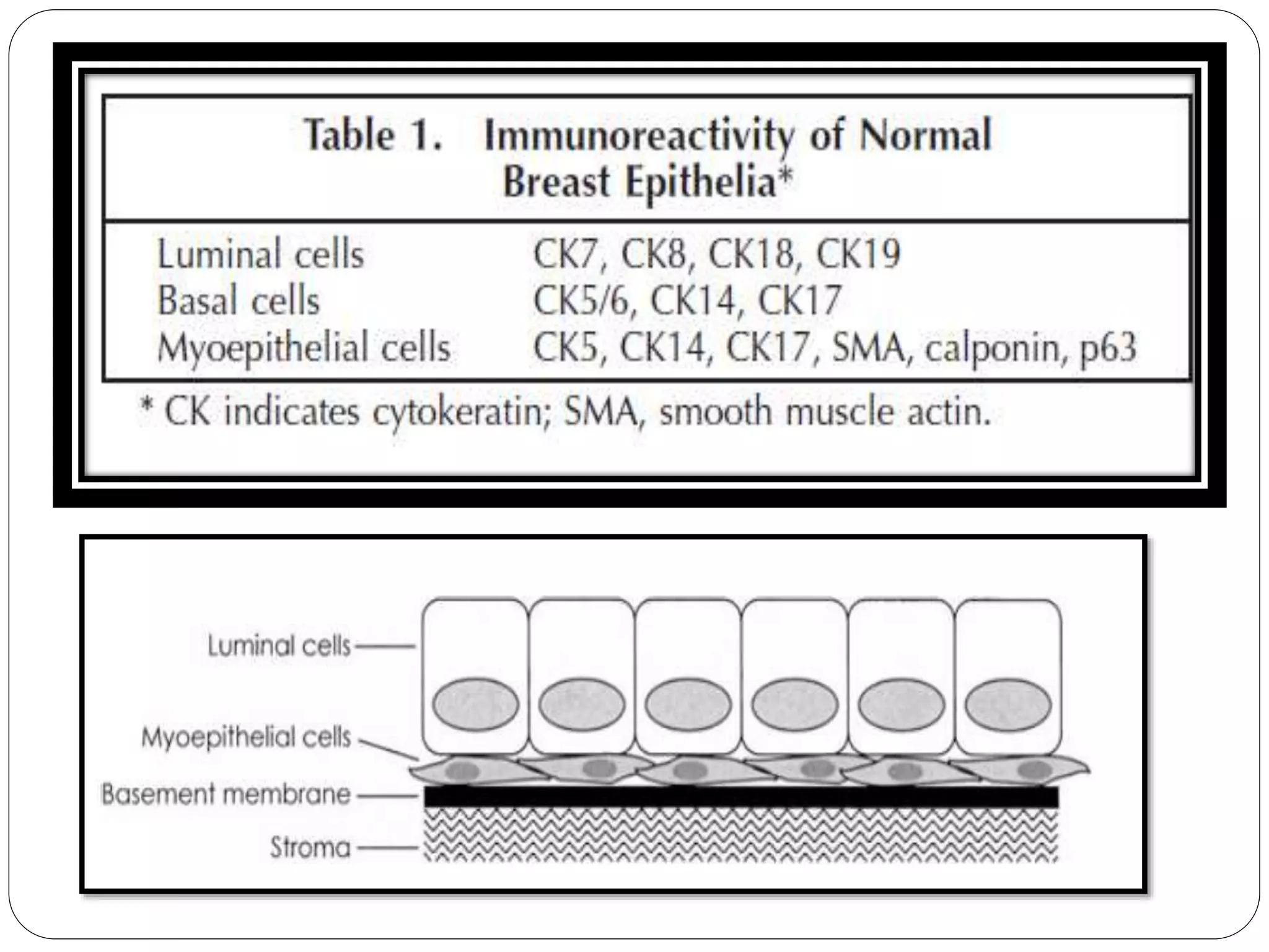 IHC In Breast Pathology PPTX ihc-in-breast-pathology-pptx