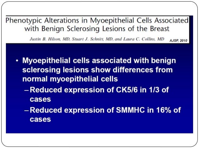 Ihc In Breast Pathology