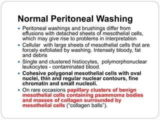 Normal Peritoneal Washing
 Peritoneal washings and brushings differ from
effusions with detached sheets of mesothelial cells,
which may give rise to problems in interpretation
 Cellular with large sheets of mesothelial cells that are
forcely exfoliated by washing. Intensely bloody, fat
and debris
 Single and clustered histiocytes, polymorphonuclear
leukocytes - contaminated blood.
 Cohesive polygonal mesothelial cells with oval
nuclei, thin and regular nuclear contours, fine
chromatin and small nucleoli.
 On rare occasions papillary clusters of benign
mesothelial cells containing psammoma bodies
and masses of collagen surrounded by
mesothelial cells (“collagen balls”).
 