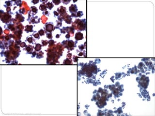 20x
Copyright © 2012 Hologic, All rights reserved.
 