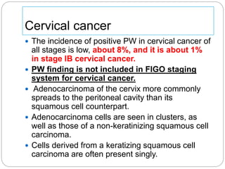 Cervical cancer
 The incidence of positive PW in cervical cancer of
all stages is low, about 8%, and it is about 1%
in stage IB cervical cancer.
 PW finding is not included in FIGO staging
system for cervical cancer.
 Adenocarcinoma of the cervix more commonly
spreads to the peritoneal cavity than its
squamous cell counterpart.
 Adenocarcinoma cells are seen in clusters, as
well as those of a non-keratinizing squamous cell
carcinoma.
 Cells derived from a keratizing squamous cell
carcinoma are often present singly.
 