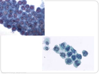 20x
Copyright © 2012 Hologic, All rights reserved.
 