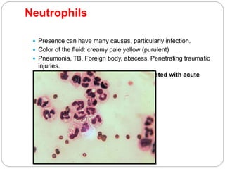 Neutrophils
 Presence can have many causes, particularly infection.
 Color of the fluid: creamy pale yellow (purulent)
 Pneumonia, TB, Foreign body, abscess, Penetrating traumatic
injuries.
 Malignant effusions are seldom associated with acute
inflammation
 