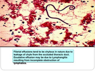 Filarial effusions tend to be chylous in nature due to
leakage of chyle from the occluded thoracic duct.
Exudative effusion may be due to Lymphangitis
resulting from incomplete obstruction of
lymphatics.
 