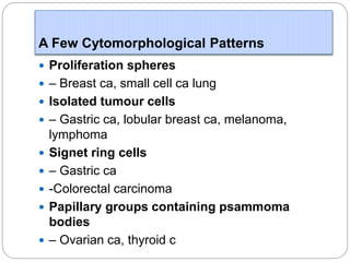 A Few Cytomorphological Patterns
 Proliferation spheres
 – Breast ca, small cell ca lung
 Isolated tumour cells
 – Gastric ca, lobular breast ca, melanoma,
lymphoma
 Signet ring cells
 – Gastric ca
 -Colorectal carcinoma
 Papillary groups containing psammoma
bodies
 – Ovarian ca, thyroid c
 