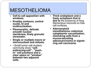 MESOTHELIOMA
 Cell to cell apposition with
windows.
 Knobby contours, central
nuclei, bi and
multinucleation.
 Pleomorphic, delicate
smooth nuclear
membrane, finely granular
chromatin.
 Single or multiple macro or
micronucleoli and mitosis.
 • Small tumor cell clusters
commonly show “cell-
embracing-cell” , "push-
in“ cell junctions and a
clear space or “window”
between two adjacent
cells.
 Thick endoplasm and a
fuzzy ectoplasm that is
due to the presence of long
filamentous microvilli on free
cell surfaces.
 Adenomatoid
mesothelioma- extensive
cytoplasmic vacuolization,
mimicking cells from a
mucus-secreting
adenocarcinoma or signet-
ring cell carcinoma.
 