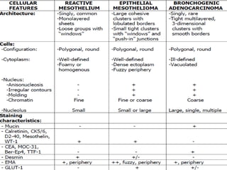 PK-like cells in effusion specimens was
highly specific for the diagnosis of MM,
especially when the PK-like cells were
moderate or numerous
 
