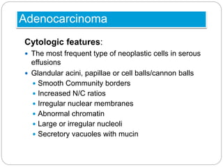 Adenocarcinoma
Cytologic features:
 The most frequent type of neoplastic cells in serous
effusions
 Glandular acini, papillae or cell balls/cannon balls
 Smooth Community borders
 Increased N/C ratios
 Irregular nuclear membranes
 Abnormal chromatin
 Large or irregular nucleoli
 Secretory vacuoles with mucin
 