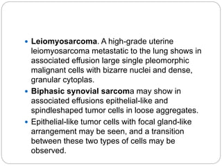  Leiomyosarcoma. A high-grade uterine
leiomyosarcoma metastatic to the lung shows in
associated effusion large single pleomorphic
malignant cells with bizarre nuclei and dense,
granular cytoplas.
 Biphasic synovial sarcoma may show in
associated effusions epithelial-like and
spindleshaped tumor cells in loose aggregates.
 Epithelial-like tumor cells with focal gland-like
arrangement may be seen, and a transition
between these two types of cells may be
observed.
 