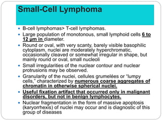 Small-Cell Lymphoma
 B-cell lymphomas> T-cell lymphomas.
 Large population of monotonous, small lymphoid cells 6 to
12 µm in diameter.
 Round or oval, with very scanty, barely visible basophilic
cytoplasm, nuclei are moderately hyperchromatic,
occasionally cleaved or somewhat irregular in shape, but
mainly round or oval, small nucleoli
 Small irregularities of the nuclear contour and nuclear
protrusions may be observed.
 Granularity of the nuclei, cellules grumelées or “lumpy
cells,” characterized by numerous coarse aggregates of
chromatin in otherwise spherical nuclei.
 Useful fixation artifact that occurred only in malignant
disorders, but not in benign lymphocytes.
 Nuclear fragmentation in the form of massive apoptosis
(karyorrhexis) of nuclei may occur and is diagnostic of this
group of diseases
 