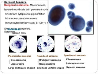 • Isolated cells
Pleomorphic sarcoma
Osteosarcoma
Liposarcoma
Large and bizarre shaped
Round cell sarcoma
Rhabdomyosarcoma
Neuroblastoma
Small and uniform shaped
Spindle cell sarcoma
Fibrosarcoma
Leiomyosarcoma
Synovial sarcoma
Sarcomas
Germ cell tumours.
Malignant melanoma- Macronucleoli.
Isolated round cells with prominent nucleoli
Fine brown cytoplasmic pigmentation
Intranuclear pseudoinclusions
Immunocytochemistry stain: S-100(+), HMB-45(+)
Small round cell tumors.
Sarcomas.
 