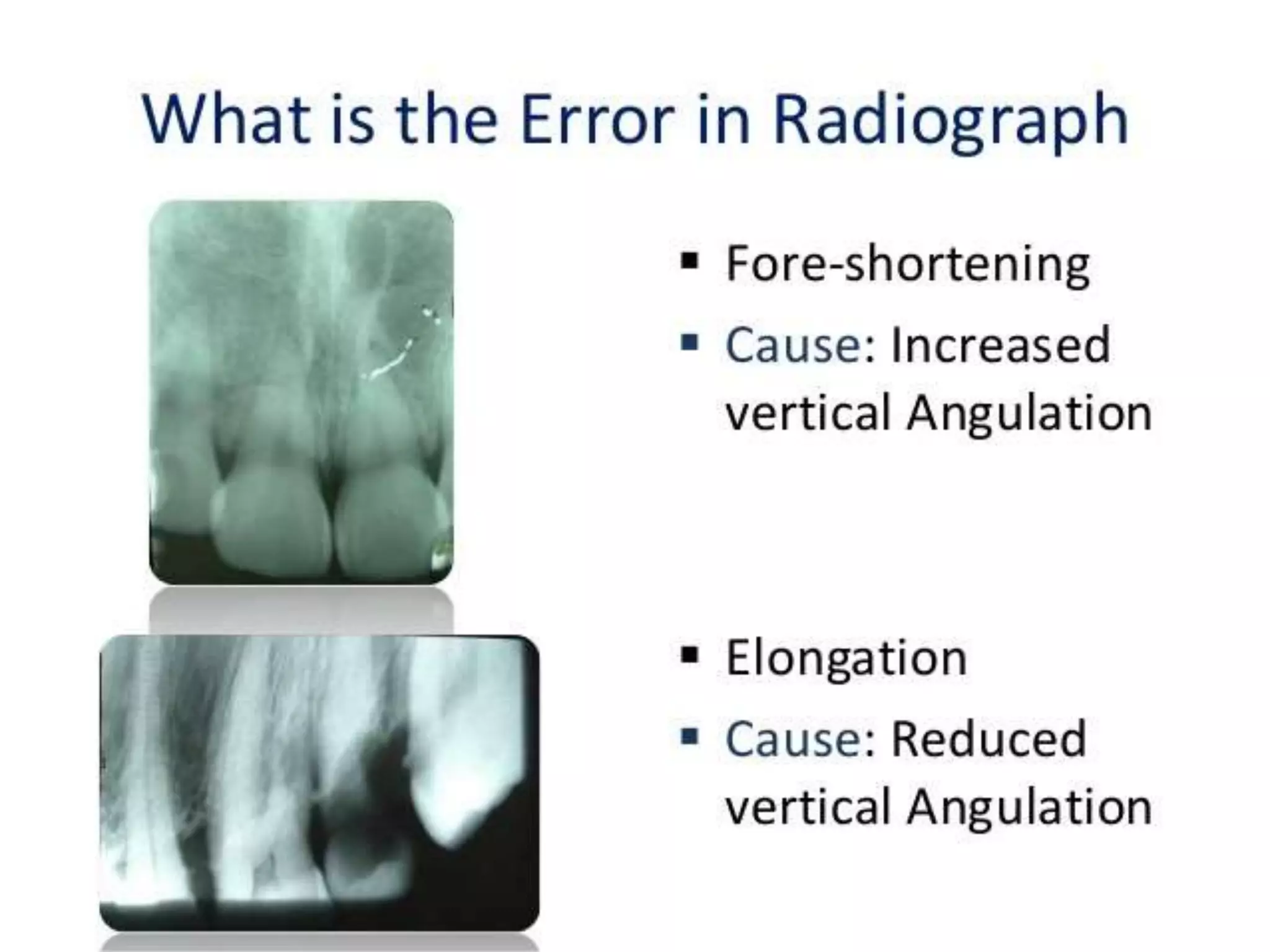 Shortening or
lengthening of the
teeth depend on the
vertical angulation
Increase vertical
angulation decrease
the length of teeth
and vise versa
