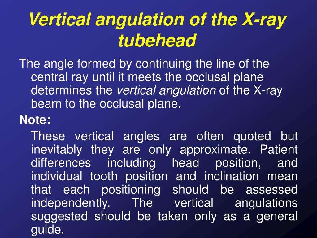 Bisecting angle technique