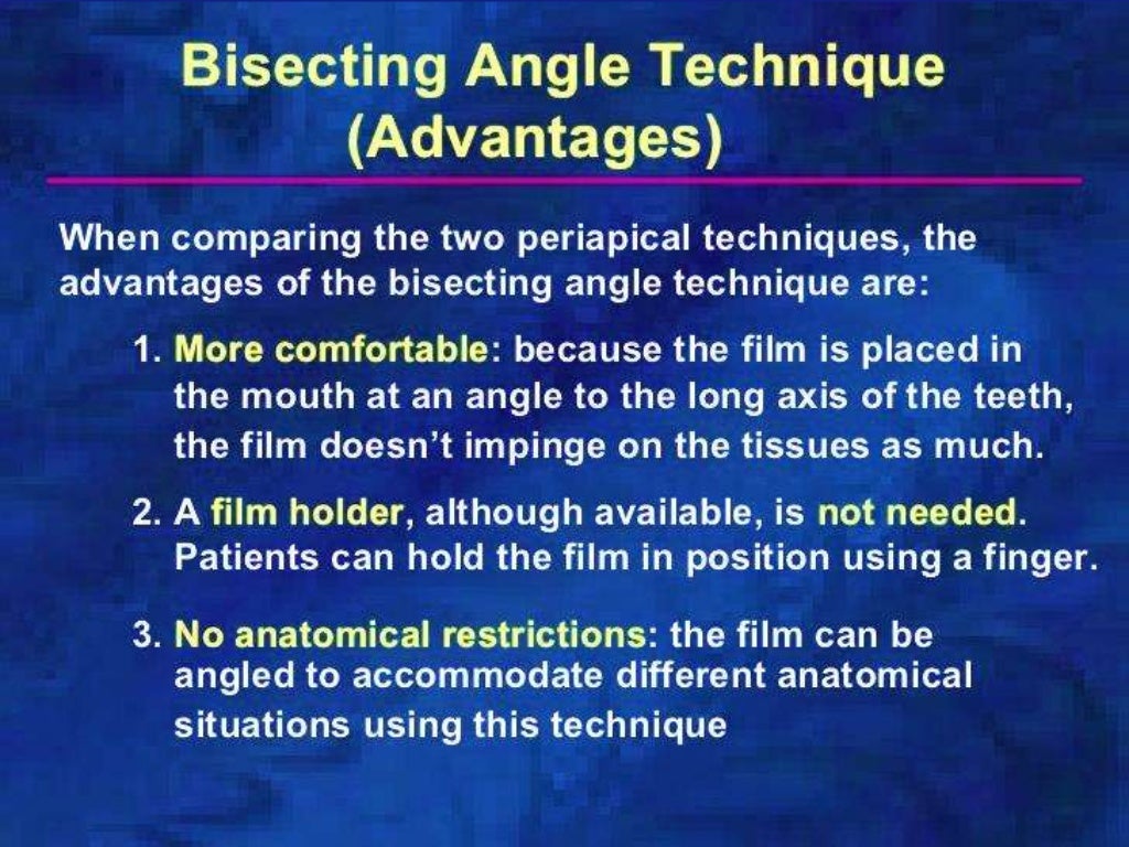 Bisecting angle technique