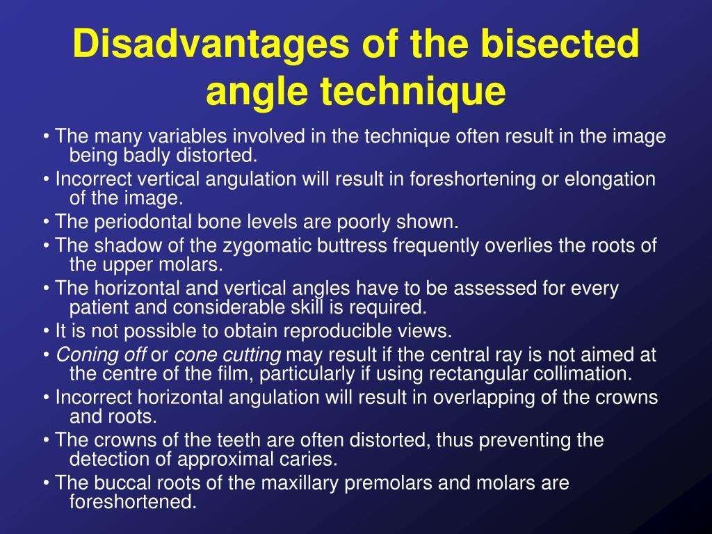 Bisecting angle technique