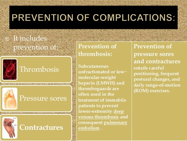 Guillian Barre Syndrome