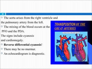 d-Transposition of the Great
Arteries
 Pathophysiology
 Cyanosis due to failure of delivery of pulmonary venous
blood to...
