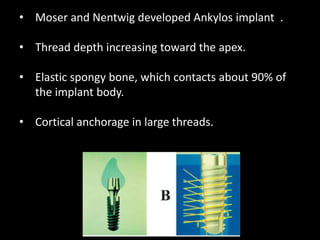 • Moser and Nentwig developed Ankylos implant .
• Thread depth increasing toward the apex.
• Elastic spongy bone, which contacts about 90% of
the implant body.
• Cortical anchorage in large threads.
 