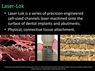 Laser-Lok
• Laser-Lok is a series of precision-engineered
cell-sized channels laser-machined onto the
surface of dental implants and abutments.
• Physical, connective tissue attachment.
Pecora GE, Ceccarelli R, Bonelli M, Alexander H, Ricci JL. Clinical evaluation of laser microtexturing for soft tissue and bone attachment to
dental implants. Implant Dent. 2009 Feb;18(1):57-66.
 