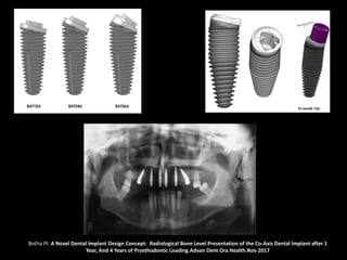 Botha PJ. A Novel Dental Implant Design Concept: Radiological Bone Level Presentation of the Co-Axis Dental Implant after 1
Year, And 4 Years of Prosthodontic Loading.Advan Dent Ora Health.Nov 2017
 